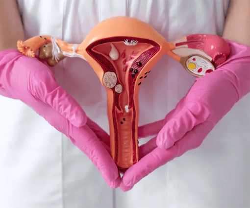 Conférence sur l'Endométriose 1 ENdometriose